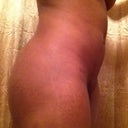 8wk post