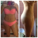 Loving my new bikini body. Almost 3 weeks post op. can't wait to see what I'll look like by May.