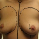 Pre op drawing