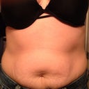 Before front..YUCK!