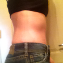 After Side :) 5 Weeks po