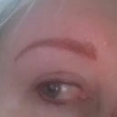 taken 2 days after..brow line still very red underneath but shape is great.
