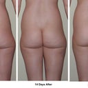 Surgery 2
