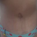 Belly button- 3 months
