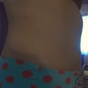 Side view- 3 months