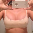 11 days post op