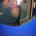 Before BBL: Stomach