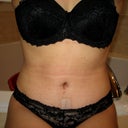 PO day 28.  No more stomach pooch sitting down.