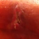 Sore spot