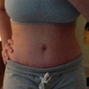 3 weeks (21 days) Post Op