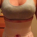 1 day Post op