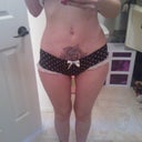 2 days shy of being 2 months post op.
