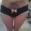 2 days shy of being 2 months post op.