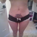 2 days shy of being 2 months post op.
