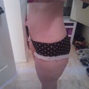 2 days shy of being 2 months post op.