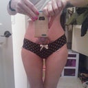 2 days shy of being 2 months post op.