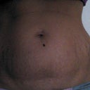 3 days pre op