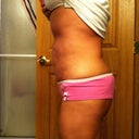 side shot,  a little swelled