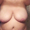 42G