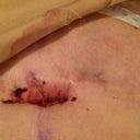 Close up of the bellybutton.....not to thrilled!