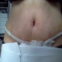 5 days post