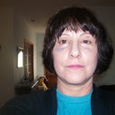 10 days after w/some makeup on bruises.  I had a lot of work done w/my deviated septum, so I bruised some.
