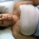 After surgery still asleep