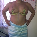 3 days after surgery first real shower
