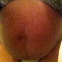 Pre-lipo Front