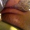 Pre-lipo Side