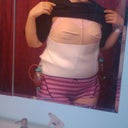 after surgery :)