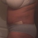 week 3 still sore and swollen
