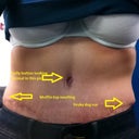 Over all liking what I see... but darn lil' dog ear.. and some swelling.. but what can a girl ask for at 5 weeks? :)