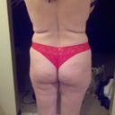 Before treatment
