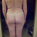 After one treatment