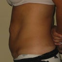 Got my before pictures sent to me by my PS