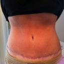 7 weeks PO