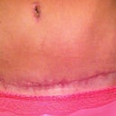 7 weeks PO