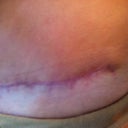 7 weeks PO