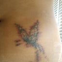 Day after my 2nd session. Compare that to the first picture.