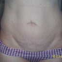 Pre-Op