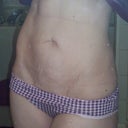 Pre-Op