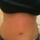 2 months pre-op