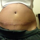 Swollen really bad