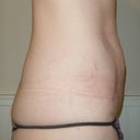 Side view before.