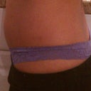 DAY 4 lower abdomen