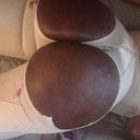 1st post op pic
