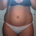 Before Front View