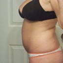 Before Side View