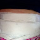 Bandages